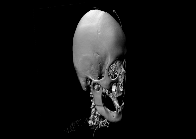 LightningChart WPF volume-rendering-skull-iso-surface example
